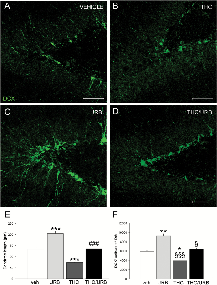 (A-D) Representative confocal microscopy images of immunofluorescent doublecortin (DCX) labeling (green) in dentate gyrus (DG) of vehicle-, Δ9-tetrahydrocannabinol (THC)-, URB-, and THC/URB-treated rats. Scale bar: 75 µm. (E) Quantification of apical dendrite length in DG DCX+ neuroblasts. Compared with the vehicle-treated group, DCX+ cells had significantly longer apical dendrites in URB-treated rats. Conversely, mean dendritic length of DCX+ cells was significantly decreased in THC- vs vehicle-treated rats. No difference was observed between vehicle- and THC/URB-treated groups. Data are expressed as mean±SEM of n=4 rats/group and were analyzed by 2-way ANOVA followed by Tukey’s posthoc test. ***P<.001 vs vehicle; ###P<.001 vs THC. (F) Quantification of DCX+ cells per mm3 of DG. URB-treated rats had significantly more DCX+ cells compared with vehicle-, THC-, and THC/URB-treated rats. Data are expressed as mean±SEM cells/mm3 of n=4 rats/group and were analyzed by 2-way ANOVA, followed by Tukey’s posthoc test. *P<.05 and **P<.01 vs vehicle-treated rats; §§§P<.001 and §P<.05 vs URB-treated rats.