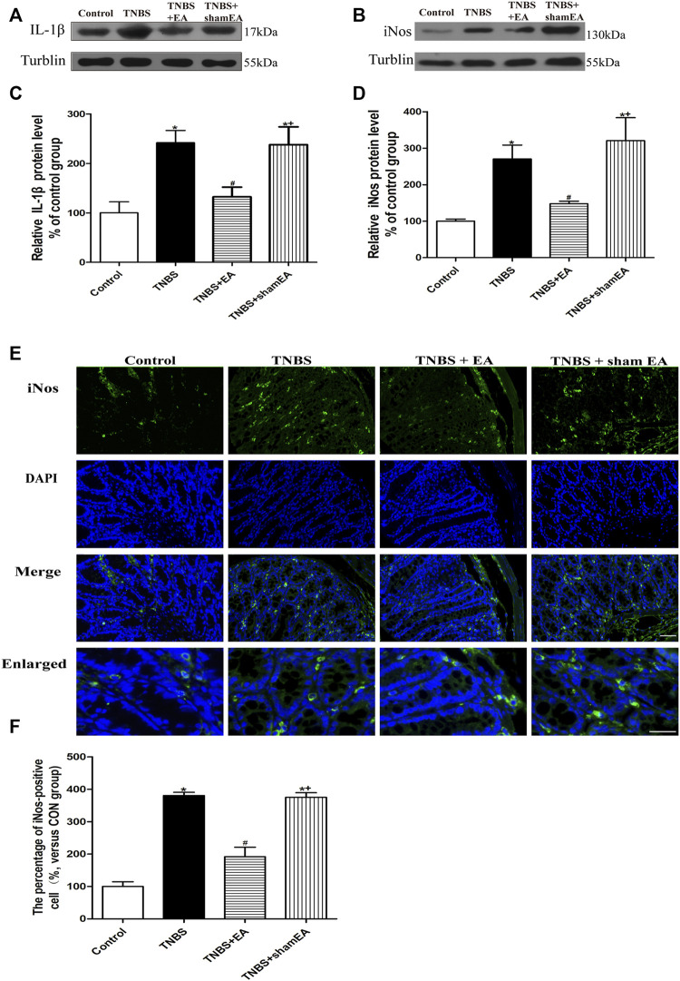 EA inhibits inflammatory responses in TNBS-treated mice. (A–E) Representative western blot images show the protein levels of IL-1β (A) and iNOS (B) in the colon tissues. Summary data show the relative protein level of IL-1β (C) and iNOS (D) in the colon tissues. (E) Representative images of immunofluorescence staining in which cell nuclei were labeled with DAPI (blue) and anti-iNOS antibody (green) in the colon tissues. (F) Summary data showing the number of iNOS-positive cells per observation field. Data are expressed as mean ± SEM (n = 6 per group). Scale bar, 50 μm *p < 0.05 versus with Control group, #p < 0.05 versus with TNBS group, +p < 0.05 versus with TNBS + EA group.