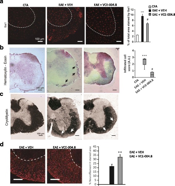 VCE-004.8 significantly reduces microglial reactivity and infiltration of inflammatory cells and preserves myelin structure in EAE animals. Cross-sectional images of thoracic–lumbar spinal cord cross-sections of 30 μm thick, in which immunofluorescence with anti-Iba1 (a), H-E (b), cryomyelin (c), and neurofilament H staining (d) immunohistochemistry was performed. Treatment with VCE-004.8 reduces the number of cell infiltrates (b, arrows) and a significant decrease in microglial reactivity (a). The quantifications are shown as means ± SEM, and significance was determined by Kruskal–Wallis non-parametric test. ***p < 0.001 vs CFA; #p < 0.05 ###p < 0.001 vs EAE + VEH. Scale bar: 150 μm (a), 100 μm (c and e). *p < 0.05 unpaired two-tailed Student’s t test (d)