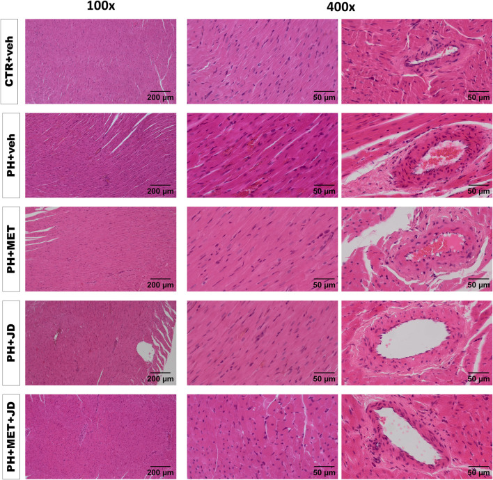 Influence of pulmonary hypertension, metformin (MET), JD5037 (JD) and/or their combination on right ventricular remodeling in monocrotaline-induced pulmonary hypertensive (PH) rats and their normotensive controls (CTR). Representative hematoxylin and eosin-stained right ventricle images (100x and 400x magnification); quantitative evaluation is provided in Table 2. MET (100 mg/kg), JD5037 (3 mg/kg) or their combination were administered by oral gavage once daily for 21 days; controls received vehicles (veh) instead.