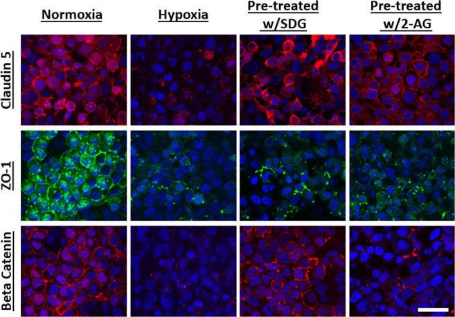 SDG and 2-AG improved tight junction distribution. Two groups of 20 organoids each were either treated with 50 µM SDG or 10 µM 2- arachidonoyl glycerol (2-AG) for 48 hours prior to culturing in hypoxic chamber. Then, another group of 20 untreated organoids and the treated groups were cultured under hypoxic condition for 24 hours. The organoids were then fixed and processed for immunohistochemistry staining and were subsequently imaged. Caludin-5 distribution and organization increased in organoids pre-treated with SDG and 2-AG. Beta catenin organization increased in organoids that were treated with SDG. Scale bars 300 μm.