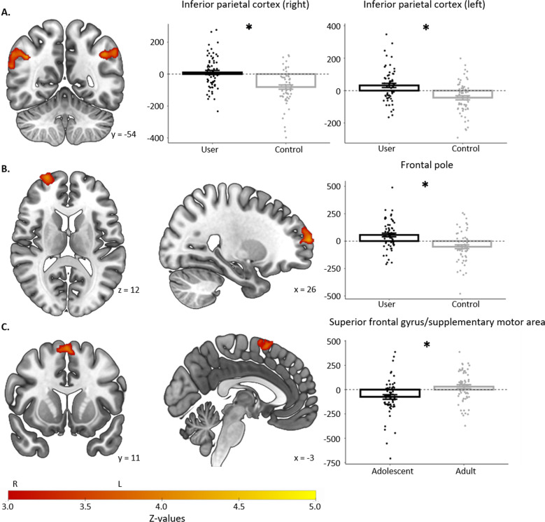 Significant group differences during reward feedback.Regions with significant User-Group or Age-Group differences during reward feedback in the whole-brain analysis, in n = 125 participants. Images are presented in radiological orientation, such that left on the image is the right hemisphere. Graphs display means and standard errors for reward feedback beta-values averaged across the given region, with individual values overlayed. A User-Group effect in right and left inferior parietal cortex. B User-Group effect in the right frontopolar cortex. C Age-Group effect in superior frontal gyrus. One-sample t-tests showed that individual group means were significantly different from zero, except for in cannabis users in the right inferior parietal cortex, and in adults in the superior frontal gyrus.