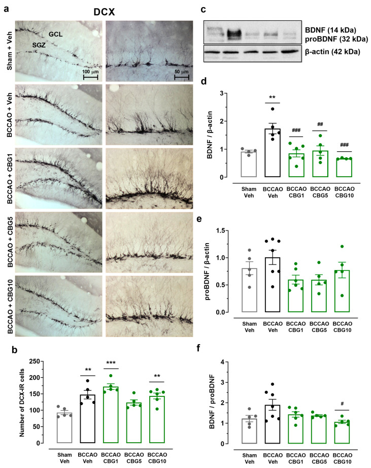 The impact of CBG on ischemia-induced neuroplasticity in the hippocampus. (a) Representative photomicrographs of DCX-immunoreactive (DCX-IR) neurons in the GCL and SGZ of the hippocampal dentate gyrus. (b) Number of DCX-IR neurons in the SGZ and GCL of the dentate gyrus. (c) Representative Western blot bands of BDNF, proBDNF, and β-actin. (d,e) BDNF and proBDNF protein levels in the hippocampus. (f) Ratio between BDNF and proBDNF levels. The bars represent the mean ± SEM in the different groups (n = 5–7/group). ** p < 0.01, *** p < 0.001 for sham vs. BCCAO; # p < 0.05, ## p < 0.01, ### p < 0.001 for BCCAO vs. BCCAO + CBG (one-way ANOVA followed by Sidak’s test).