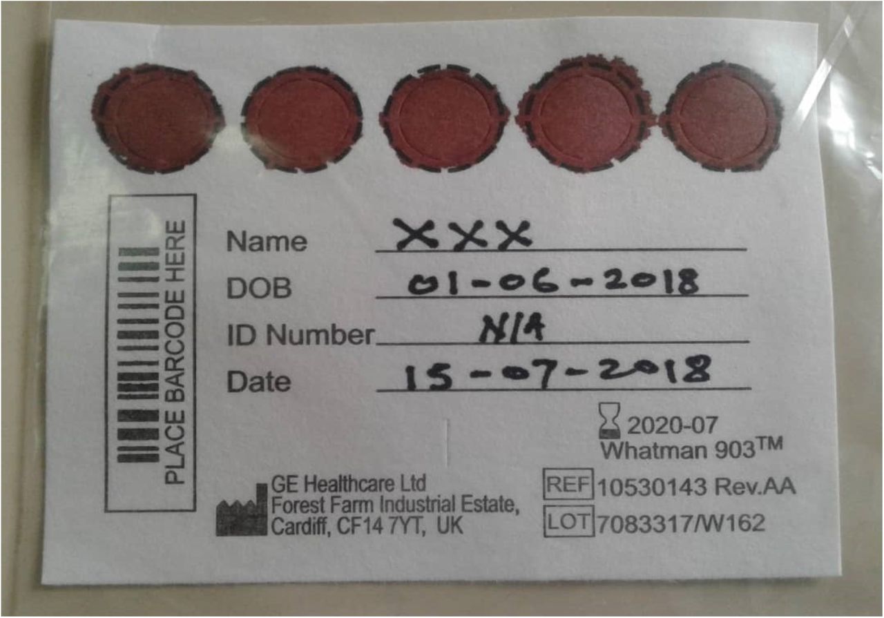 Figure 1: Sufficient dried blood spot