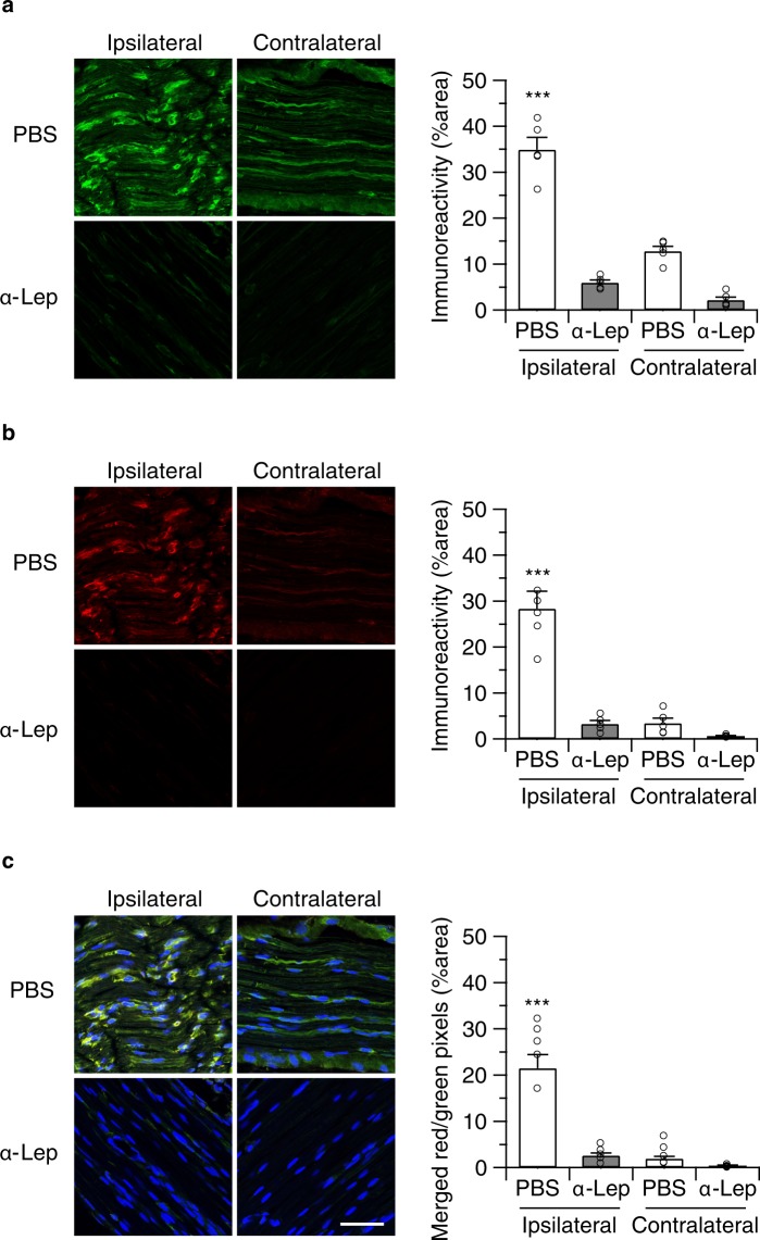Perineurally administered leptin neutralizing antibodies (20 ng/mouse/day) inhibited nerve injury-induced macrophage infiltration in CB2-KO animals. F4/80 (a) and leptin receptor expression (b) as determined by immunohistochemistry 14 days after the surgery (24 hours after the final drug treatment). Bars indicate a length of 50 μm. (c) Merged images (green: F4/80, red: leptin receptor, blue: DAPI) showed that most of infiltrated macrophages in CB2-KO animals were leptin receptor positive. Quantified immunoreactivity is expressed as percentage of positive signals to the stained area (mean ± SEM). A significant treatment effect is indicated by *** p < 0.001, compared with respective contralateral immunoreactivity (two-way ANOVA followed by Sidak’s multiple comparisons test), n = 5.