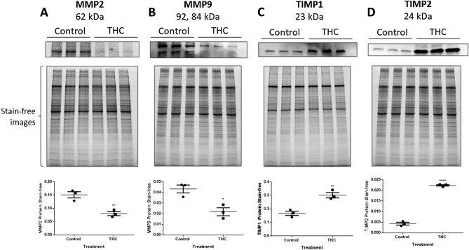 THC alters the expression of MMP and TIMP proteins in HTR8/SVneo cells. (A–D) Total protein was isolated from HTR8/SVneo cells and analyzed by Western blot (20 µg). Summary histograms of active MMP2 (A), pro-MMP9 and active MMP9 (B), TIMP1 (C), and TIMP2 (D) of relative band density in each treatment group normalized to stain-free image are shown below the Western blot images. Significant differences were determined by Student’s t-test. The individual points represent the ratios of proteins (n = 3), the horizontal lines represent the means and the error bars represent SEM. ** P < 0.01 (A,C), * P < 0.05 (B), **** P < 0.0001 (D).