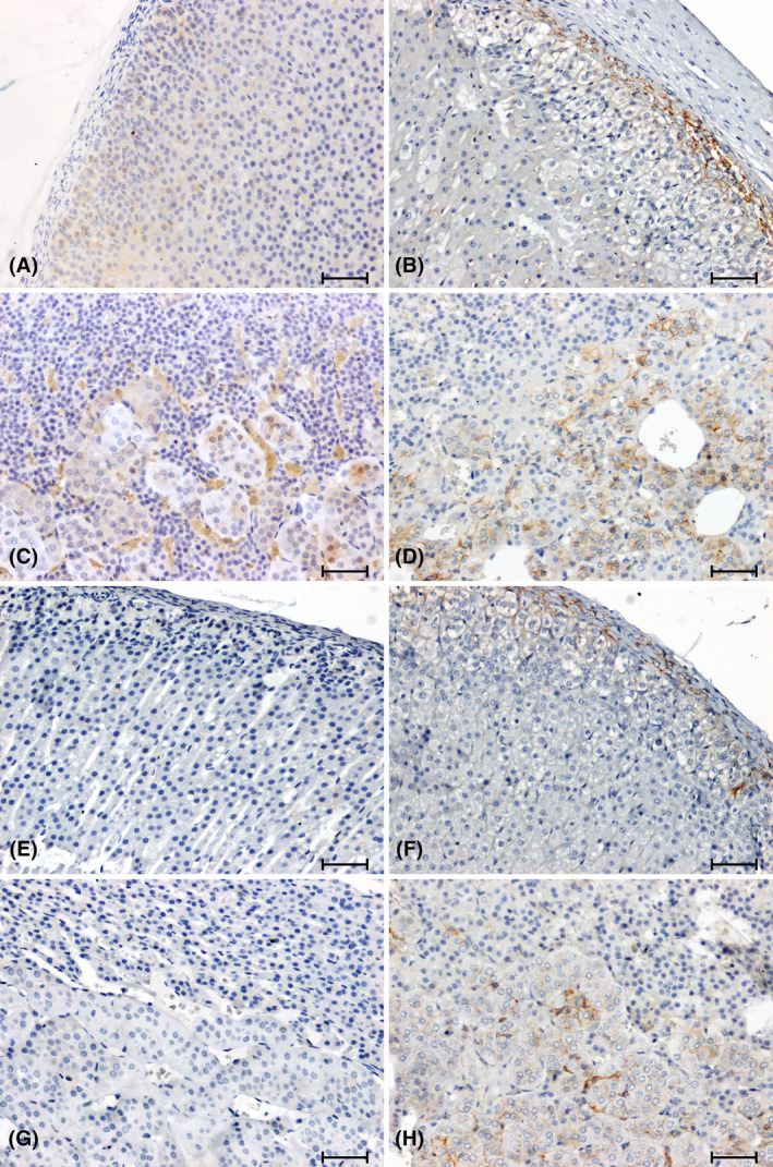 Immunohistochemical reaction determining β‐catenin in adrenal glands of normotensive (A–D) and hypertensive (E–H) rats. Adrenal cortex and medulla of WKY rat (A, C), sham‐operated (B, D); Adrenal cortex and medulla of SHR rat (E, G); 2K1C (F, H). Scale bar = 50 μm.