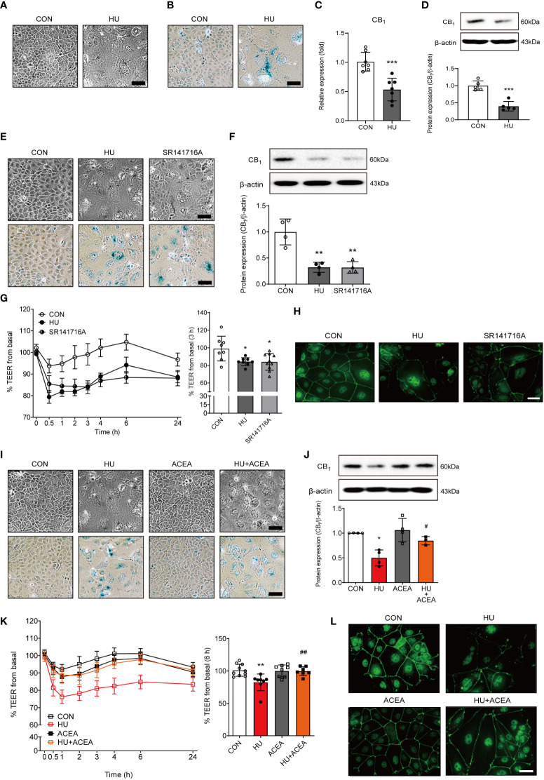 The characteristics of cell senescence and alteration of the TEER value and ZO-1 expression are regulated by CB1 signaling. (A, B) HU treatment induced morphological changes (A) and positive cell intensity in β-gal staining (B) in Caco-2 cells. Scale bar, 50 μm. (C, D) The alteration of CB1 expression was detected by qPCR (C) and western blot (D). The bar graph presents the optical density quantification of the protein bands for each group (D, bottom). Statistical differences were determined using t-test; ***p<0.001 compared to control group. Error bars, SD (n = 3). (E) Cell morphology (E, upper) and β-gal staining (E, bottom) were determined in HU-induced aged cells and SR141716A-treated Caco-2 cells. Scale bar, 50 μm. (F) Representative bands from western blot and quantitative analyses of CB1 protein expression in Caco-2 cells after HU and SR141716A treatment are shown. β-actin was used as a loading control. Error bars, SD (n = 3). **p<0.01 vs. the control group. (G) The effects of HU and SR141716A on Caco-2 cell permeability. Continual resistance values of the Caco-2 cell monolayers are shown. The bar graph presents the TEER values at 3 h after treatment with HU and SR141716A (G, right). Statistical differences were determined using t-test; *p<0.05 compared to control group. Error bars, SD (n = 8). (H) Representative pictures of IF staining of ZO-1 in Caco-2 cells treated with HU and SR141716A. Scale bar, 50 μm. (I) Cell morphology (I, upper) and β-gal staining (I, bottom) in HU-induced aged cells and/or ACEA-treated Caco-2 cells. Scale bar, 50 μm. (J) Representative bands of western blot and quantitative analyses of CB1 protein expression in Caco-2 cells after HU and/or ACEA treatment are shown. β-actin was used as a loading control. Error bars, SD (n = 3). *p<0.05 compared to control group, #p<0.05 compared to HU treatment group. (K) The effects of HU and/or ACEA on Caco-2 cell permeability. Continual resistance values of the Caco-2 cell monolayers are shown. The bar graph presents the TEER values at 6 h after treatment with HU and/or ACEA (K, right). Statistical differences were determined using t-test; **p<0.01 compared to control group, ##p<0.01 compared to HU treatment group. Error bars, SD (n = 8). (L) Representative pictures of IF staining of ZO-1 in Caco-2 cells treated with HU and/or ACEA. Scale bar, 50 μm.