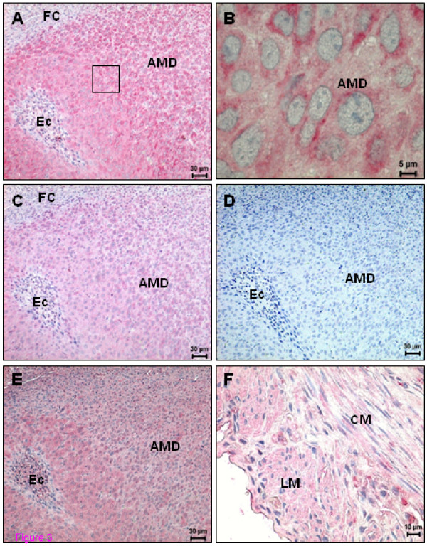 Immunohistochemical demonstration of anandamide-binding receptor expression in the rat uterus on day 8 of pregnancy. (A) CB1 expression is evenly distributed in the antimesometrial decidua; (B) Higher magnification of the square indicated in (A); (C) CB2 expression in decidual cells of antimesometrium, note that CB2 staining appears to be less intense than CB1; (D) A negative control for CB2 of a consecutive section of (C); (E) TRPV1 expression; note a higher expression in the cells close to the embryo; (F) TRPV1 expression in longitudinal and circular muscle layers. AMD - Antimesometrial decidua; CM - Circular muscle layer; Ec - Embryonic cells; FC - Fibrinoid capsule; LM - Longitudinal muscle layer.