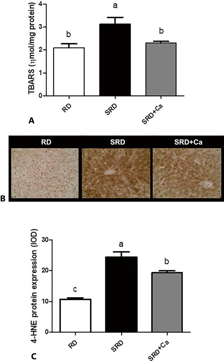 Lipid peroxidation in rats fed a reference diet (RD), sucrose-rich diet (SRD), or SRD with cannabis oil (SRD + Ca). A Thiobarbituric acid reactive substance (TBARS) in the liver. Values are mean ± SEM (n = 6). Bars that do not share the same letter are significantly different (p < 0.05). B Representative photomicrographs of 4-HNE expression in liver sections of rats. An increase of hepatocytes with nuclear and cytoplasmic positive markers is observed in the SRD group. ×400 magnification. C Quantitative immunohistochemical analysis of expression of 4-HNE in the liver. Values are expressed as mean ± SEM, n = 6. Bars that do not share the same letter are significantly different (p < 0.05) when one variable at a time was compared by one-way ANOVA followed by Newman-Keuls test.