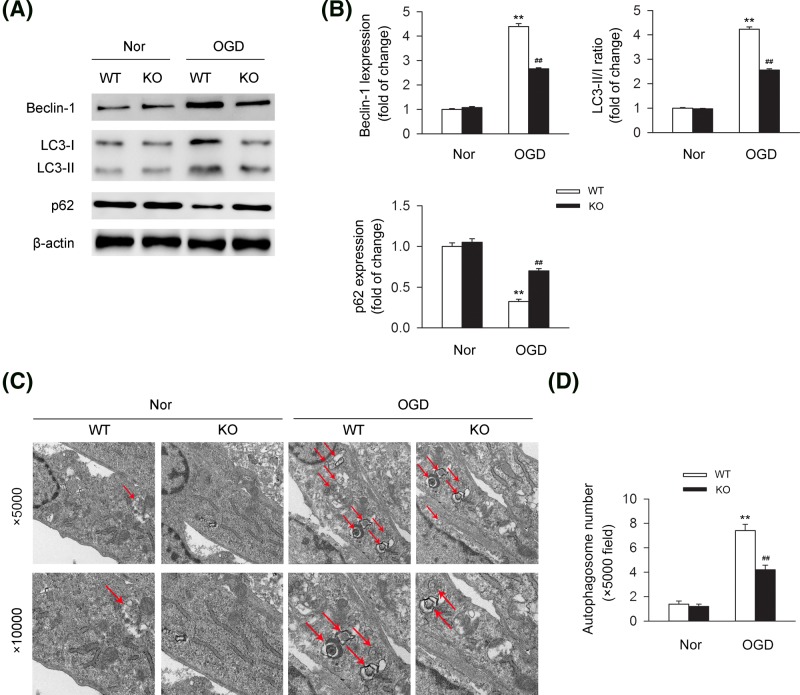 CB2R deficiency results in the dysfunction of autophagy in cardiomyocytes under OGDPrimary cardiomyocytes isolated from WT or CB2R KO mice were exposed to OGD for 6 h. (A) Levels of autophagy-related proteins including Beclin-1, LC3-II/I, and p62 were detected by western blot. (B) Quantitative analysis of the relative Beclin-1, LC3-II/I ratio, and p62 expression (n=five per group). **P<0.01 versus WT nor; ##P<0.01 versus WT OGD. (C) The number of autophagosomes was detected by transmission electron microscopy with lower magnification (×5000, upper line) and higher magnification (×10,000, lower line). (D) Quantitative analysis of the number of autophagosomes with lower magnification (×5000) (n=five per group). **P<0.01 versus WT nor; ##P<0.01 versus WT OGD.Nor, normal.