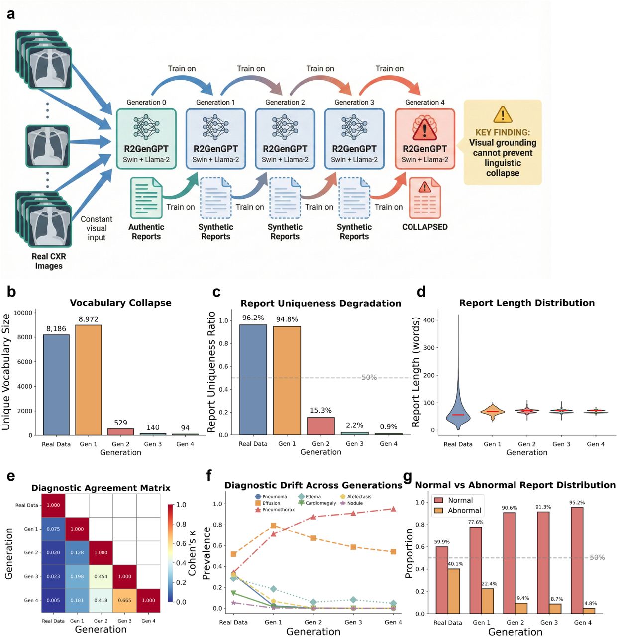 AI-generated data contamination causes degradation of linguistic diversity and clinical knowledge in vision–language model-based radiology report generation.a, Schematic of the self-referential training framework for R2GenGPT (Swin-Transformer + Llama-2): models receive constant real chest X-ray images as visual input while training exclusively on synthetic reports from the preceding generation, isolating the effect of text degradation from visual signal quality. b–d, Lexical collapse. Metrics demonstrate a near-total loss of linguistic diversity, characterized by a plummeting vocabulary size (b; from 8,186 to 94 unique words), a collapsing report uniqueness ratio (c; 96.2% to 0.9%), and converging report lengths. (d) Despite access to real radiographs, the model regresses to a handful of repetitive, generic phrases.e, Diagnostic divergence. A diagnostic agreement matrix (Cohen’s κ) reveals a progressive dissociation between baseline interpretations and subsequent generations. f, Divergent diagnostic prevalence during progressive model collapse. As the model iterates from baseline to Generation 4, detection rates for grounded pathologies (e.g., cardiomegaly, atelectasis) decline toward zero, reflecting the loss of true clinical signal. Conversely, pneumothorax detection exhibits a paradoxical increase (from 34.2% to 95.2%), indicating the emergence of hallucinations driven by model priors rather than visual evidence. g, Shift toward false reassurance. The distribution of normal versus abnormal classifications inverts from 60% normal (baseline) to 95% normal (Generation 4), demonstrating that models default to "healthy" outputs even when presented with pathological images.