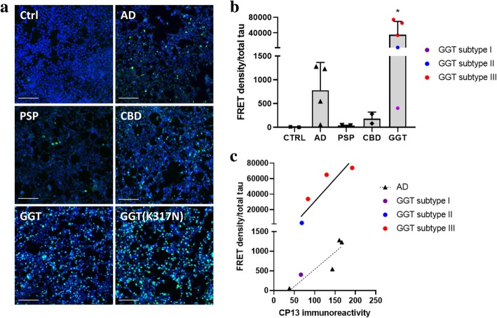 GGT brain lysates contain significantly higher tau seeding potency compared to other tauopathies. a Incubation of the tau biosensor cell line with brain lysates of sporadic or mutant (p.K317 N) GGT cases, resulted in induction of numerous GFP-positive puncta that are indicative of robust tau seeding. Representative confocal microscopy images are shown (scale bar = 100 μm). b Significant tau seeding activity of GGT brain lysates was measured by the FRET flow cytometry assay. FRET density was normalized to the amount of total tau present in the sample. Data are presented as mean ± SD (*p < 0.05 compared to control). c Analysis of p-tau burden from corresponding GGT and AD brain sections stained with CP13 p-tau antibody (pS202) demonstrated that GGT cases with similar p-tau burden to AD cases still induced robust FRET signals (R = 1, p = 0.0167 [GGT]; R = 0.8, p = ns [AD])