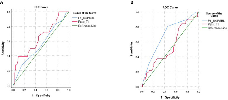 The figure shows AUC for female (A) and male (B) CHR participants since the significant conversion effects on startle latency were present in the females but not males. Startle latency (PA lat_t1) was more predictive of later conversion in females (AUC = 0.65) than males (AUC = 0.54) while P1, a measure of unusual thought content from the SIPS (P1_SOPSBL) was more predictive of later psychosis in males (AUC = 0.69) than in females (AUC = 0.55) but both were short of statistical significance.