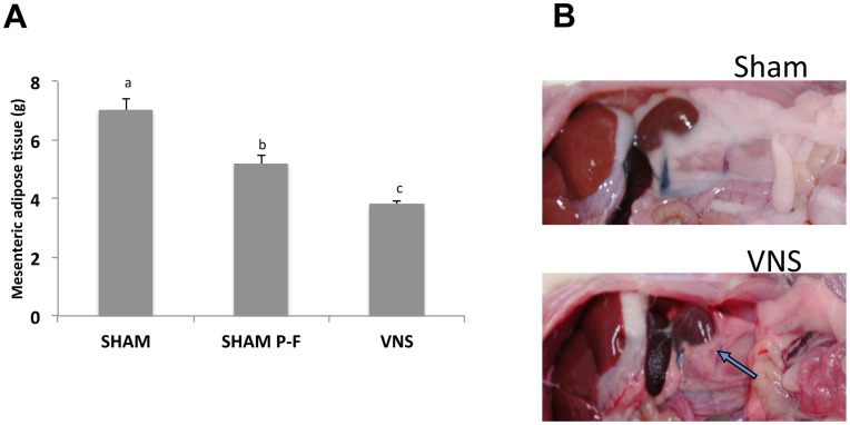Effects of VNS on plasma and tissue levels of NEFA.NEFA levels were determined in plasma (A), mesenteric adipose tissue (B), and liver (C) of rats treated with VNS for 4 weeks or in the plasma of those subjected to acute VNS for 3 h (D). Data are means ± SEM for nine animals per group. *P<0.05 versus the corresponding value for sham-operated control rats (Scheffe’s test).