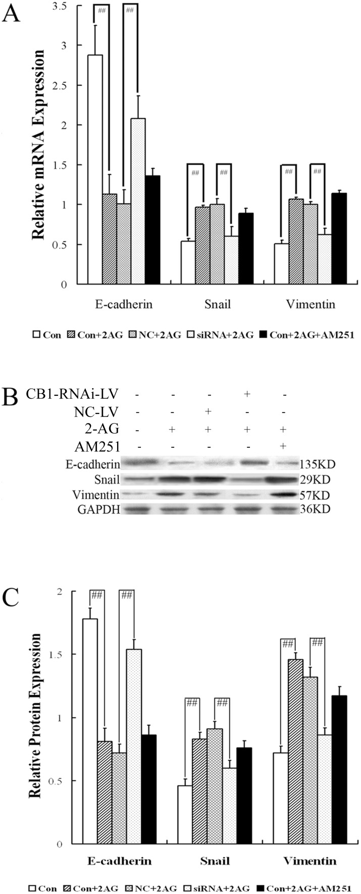 Effect of CB1-RNAi-LV on Mesenchymal-Epithelial Transitions of primary hepatic stellate cells.(A) The statistical results of E-cadherin, Snail and Vimentin mRNA expression in HSCs (named Con), HSCs with 2-AG (named Con+2AG), HSCs with NC-LV and 2-AG (named NC+2AG), HSCs with CB1-RNAi-LV and 2-AG (named siRNA+2AG), HSCs with 2-AG and AM251 (named Con+2AG+AM251) by RT-PCR analysis. Relative expression levels of mRNA were normalized against those of GAPDH mRNA. “# #” p<0.01. (B) shows representative graphs of E-cadherin, Snail and Vimentin protein expression by Western blot analysis and (C) shows the statistical results. These data indicated that the mRNA and protein expressions of E-cadherin in HSCs were down-regulated significantly by 2-AG stimulation, while the levels of Snail and Vimentin were up-regulated significantly by 2-AG stimulation. On the other hand, the expression level of E-cadherin in HSCs with CB1-RNAi-LV transfection and 2-AG stimulation were increased markedly than that in HSCs with NC-LV transfection and 2-AG stimulation, while the expression levels of Vimentin and Snail in HSCs with CB1-RNAi-LV transfection and 2-AG stimulation were decreased markedly than that in HSCs with NC-LV transfection and 2-AG stimulation. The results also revealed that the expression levels of E-cadherin, Snail and Vimentin in HSCs stimulated by 2-AG were not affected by AM251 treatment.