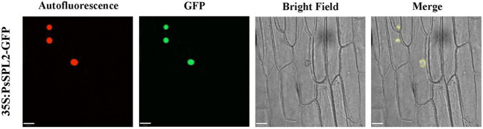Subcellular localization analysis of PsSPL2 fusion protein in onion epidermal cells.