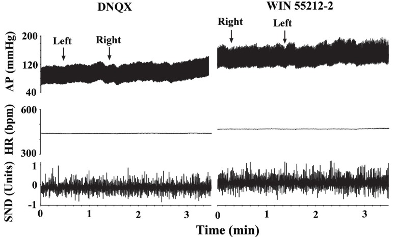Bilateral microinjection of the non-NMDA receptor antagonist DNQX antagonized the actions of WIN 55212-2. Arterial pressure (AP) and heart rate (HR) are expressed in mmHg and in beats per min (bpm), respectively. Sympathetic nerve discharge (SND) is expressed in arbitrary units.
