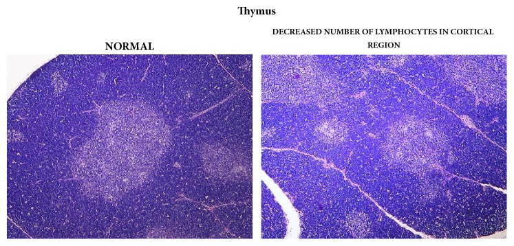 Thymus gland: comparison of normal (control) tissue to tissue in a male from the 3000/4000 mg/kg bw/day group showing decreased number of cortical lymphocytes, 14-day study.
