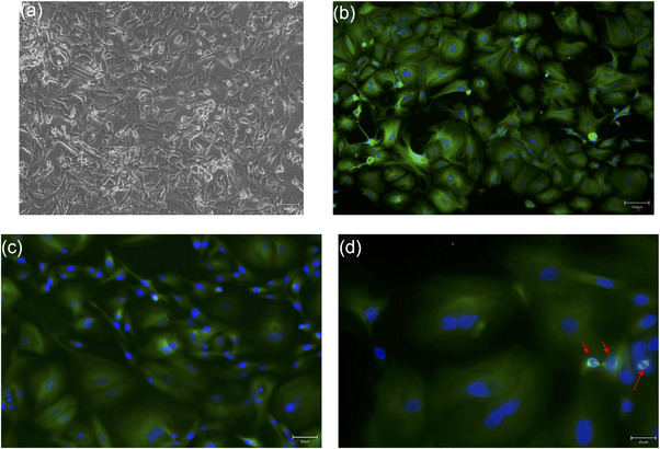Morphology and β‐tubulin immunofluorescence of canine mammary carcinoma (CMC) cells. (a‒c) Phase‐contrast image (P1) showing mixed spindle and polygonal cell shapes. Immunofluorescence: β‐tubulin (green) decorates the cytoskeleton of proliferating cells; nuclei counterstained with 4′,6‐diamidino‐2‐phenylindole (DAPI) (blue). (d) High‐magnification view highlighting β‐tubulin‐positive mitotic spindles (arrowheads).
