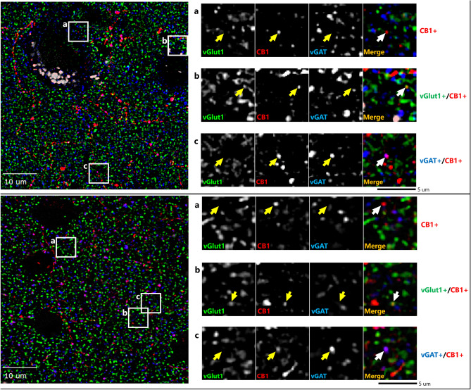 Sample micrograph of immunohistochemical staining in both human (top) and monkey (bottom) cortex. Left panels: Puncta with vGlut1 + (green), vGAT + (blue) & CB1R + (red) immunoreactivity are distributed throughout the image field. Right panels: Enlarged images with arrows identifying puncta with antibody immunoreactivity toward a single or multiple proteins.