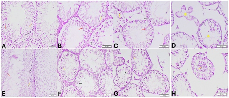 Testis sections stained by Periodic acid-Schiff (PAS) staining for sedentary (A–D) and trained (E–H) rats. Sedentary groups: (A) Control group (sedentary) showing normal spermatogonia (black arrow), spermatocytes (yellow arrow), round (red arrow) and elongated spermatids (white arrow), (B): Stanz group Showing degeneration of pachytene spermatocytes (yellow arrow) and elongated spermatids (red arrow), (C) Cann group showing degeneration of spermatogenic cell (black arrow) pachytene spermatocytes (yellow arrow) and elongated spermatids (red arrow). (D) Combined group showing absence of all germinal layers (yellow star). Trained groups: (E) Control group trained Showing normal spermatogonia (black arrow), spermatocytes (yellow arrow), round and elongated spermatids (red arrow). (F): Stanz group showing degenerated round (yellow arrow) and elongated spermatids (black arrow). (G) Cann group Showing degenerated spermatocyte (yellow arrow), and degenerated elongated spermatids. (H) Combined group Showing distorted elongated spermatids with exfoliated germinal cells (yellow arrow).