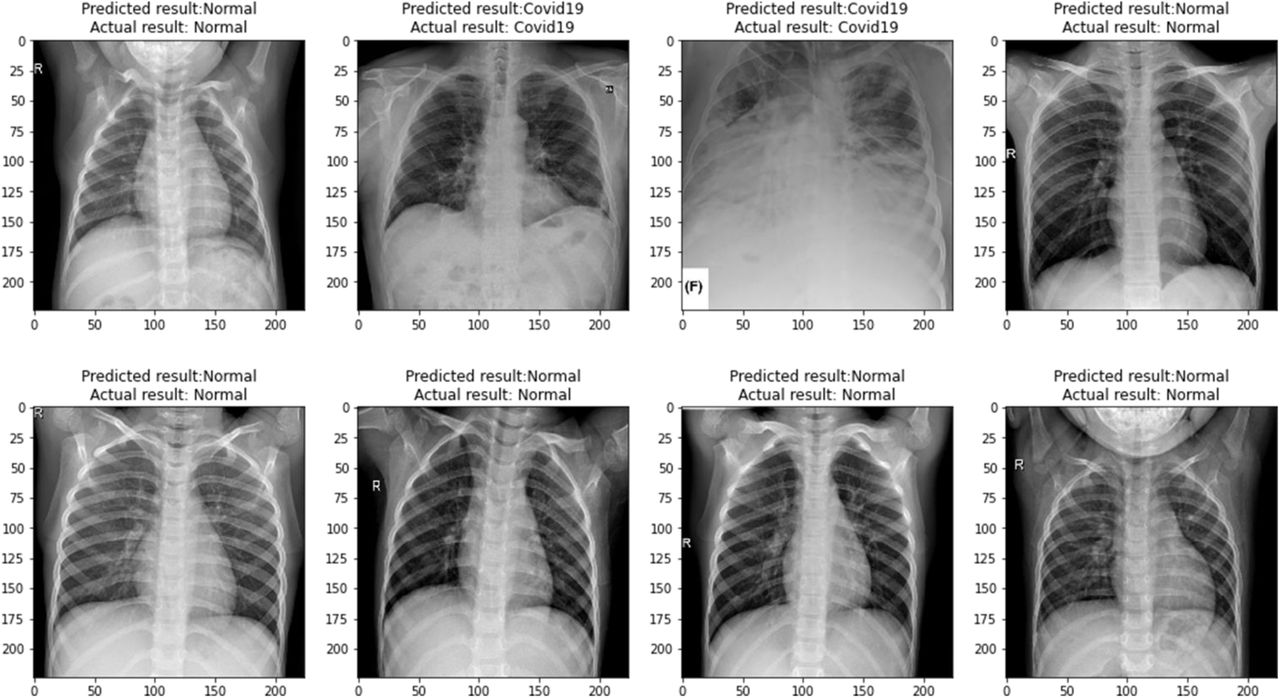 “CovidMulti-Net” evaluated some X-ray images.