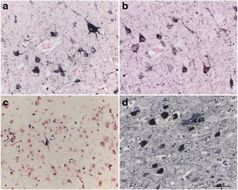 Pretangle neurons in the hippocampal pyramidal layer of the 36-year-old monkey. Tau IR with AT8 a and that with RD4 b were granular and diffuse in the neuronal cytoplasm and dendrites, rarely organized into neurofibrillary tangles. Argyrophilia with Gallyas silver impregnation was limited to a few neurons (c, arrowhead). None of these neurons exhibited fibrillary structures in their cytoplasm. In contrast, numerous neurofibrillary tangles were stained by Gallyas silver impregnation in the CA1 of a 94-year-old male with AD (d, arrowheads). Scale bar, 50 μm
