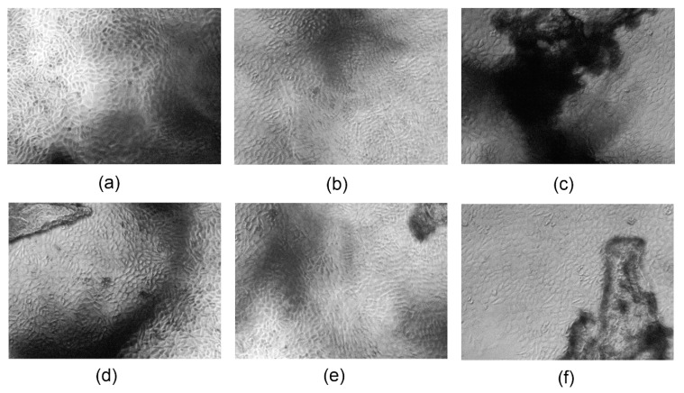 Qualitative cytotoxicity assessment of the developed samples on L929 mouse fibroblasts after six days of cell culture (40× magnification): (a) CS-ZnO-1; (b) CS-ZnO-2; (c) CS-ZnO-3; (d) CS-ZnO-4; (e) CS-ZnO-5; and (f) CS-ZnO-6.