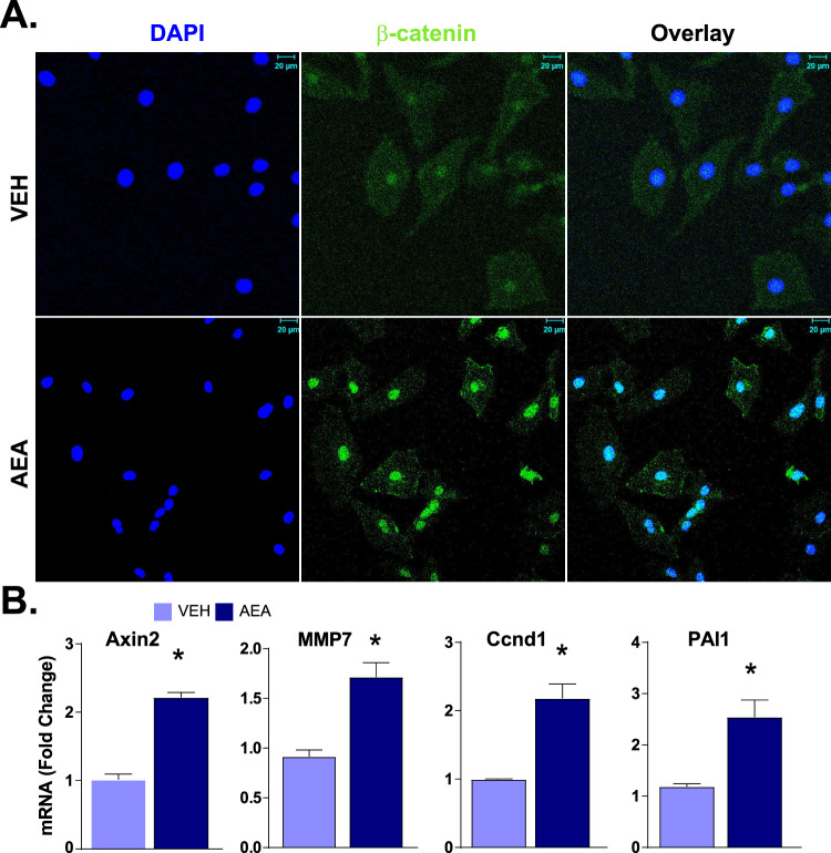 AEA induces the expression of β-catenin and its target genes in rat HPCs.A Fluorescence immune-histochemistry for β-catenin (middle), as well as DAPI staining (left), of LE2 cells treated with AEA (300 nM) and visualized by confocal microscopy. Co-localization is shown by overlay (right). B Real-time PCR analyses of the expression of β-catenin target genes Axin2, Mmp7, Ccnd1, and PAL1 in the same cells (n = 3/groups, *P < 0.05 compared to vehicle).