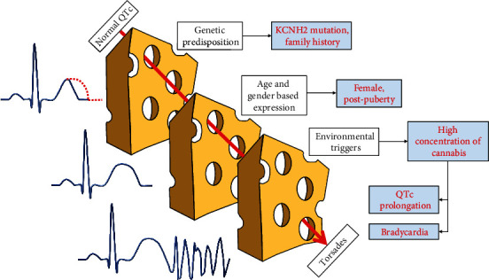Representation of “the perfect storm” that led up to Tdp and cardiac arrest. Normal QTc several years ago was likely secondary to lack of age/gender-based expression. However, when postpubertal and in the presence of a potent environmental trigger, she developed QTc prolongation and bradycardia resulting in Tdp and cardiac arrest.