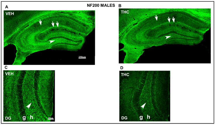 Confocal images at low magnification show abnormal immunolabeling of NF200 in THC male pups. NF200-ir (green labeling; A–D) in the HIPP of VEH (A–C) and THC (B,D) male mice at PND60. Note the decreased NF200-ir in the hillus of DG (arrowhead in B), the CA1 strata radiatum (arrow in B), and the stratum lacunosum-moleculare (double-arrow) in THC mice compared to that in VEH (A) male mice. Magnification of the hilus of the DG, the NF200-ir, is lower in the male mice of the THC group (D) than in the VEH group (C). Compared to VEH (C), these data indicate an alteration in the stabilization and maturation of connections in THC (D) male pups. DG: dentate gyrus; h: hilus; g: granular layer. The same scale applies to (A,B) and (C,D).