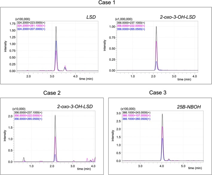MRM chromatogram of three urine samples with a positive result for at least one analyte.