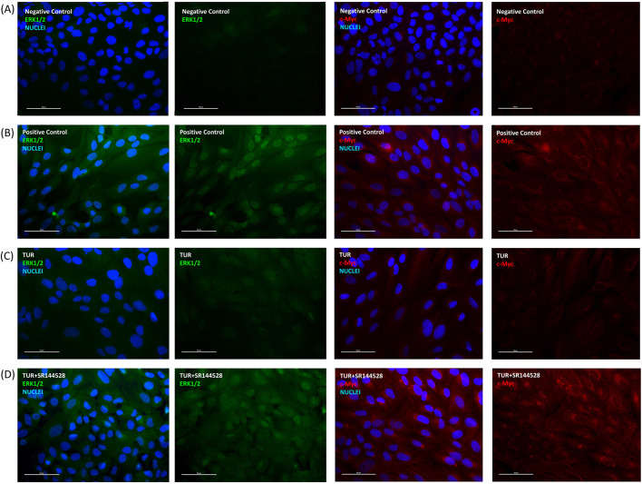 Immunofluorescence staining after inflammatory challenge. The group designated to receive the antagonist was pre-treated with 1 μM of SR144528 for 10 min. Then TUR (Turmeric oleoresin) at 15 ppm was added, and SW-1353 cells were incubated for 2 h before the challenge. Subsequently, IL-1β and TNF-α both at 10 ng/mL (positive control) were introduced as an inflammatory stimulus for 24 h. Images show nuclei (blue), total ERK (green), and c-Myc (red) in (A) negative control, (B) positive control, (C) TUR, and (D) TUR + SR144528 treated cells. Images were taken at ×40 magnification in three different fields. The scale bar corresponds to 50 μm. c-Myc = Cellular myelocytomatosis oncogene; ERK = Extracellular signal-regulated kinases.