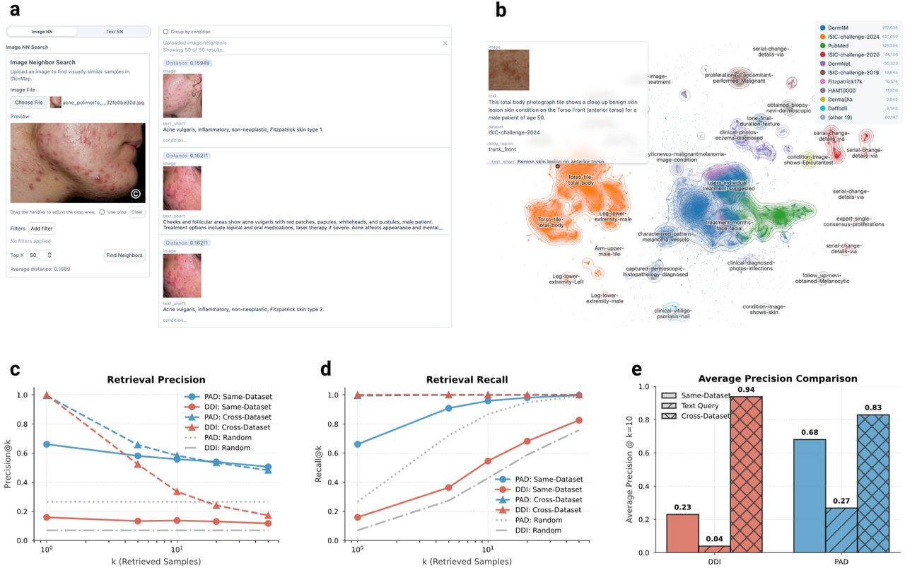 The SkinMap digital atlas for clinical decision support and strategic data steering.a, Interactive web-based interface allowing for real-time case uploads and retrieval of semantically similar cases with associated ground-truth diagnoses. b, Visualization of the global latent space, projecting diverse datasets into a unified manifold where proximity corresponds to clinical similarity and allows practitioners to explore the atlas. c–d, Benchmarking of retrieval precision (c) and recall (d) on hold-out datasets, comparing baseline performance within the same dataset against cross-dataset retrieval using the complete atlas. e, Comparison of Average Precision (at k = 10) demonstrating that while same-dataset retrieval provides a baseline for specialized cohorts like DDI, cross-dataset retrieval through the exhaustive SkinMap atlas provides a significant performance boost, increasing DDI precision from 0.23 to 0.94.