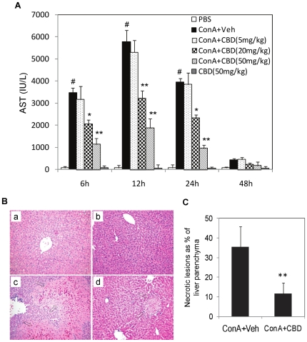 Cannabidiol (CBD) attenuates ConA-induced hepatitis in mice.WT mice (n = 6) were injected with PBS (control), or ConA (12.5 mg/kg bd.wt., i.v.) to induce hepatitis. ConA injected mice were administered i.p. with vehicle or CBD at 5, 20 or 50 mg/kg bd.wt. CBD group received CBD alone at 50 mg/kg. A) Blood was collected at 6, 12, 24 and 48 h and serum aspartate transaminase (AST) was determined by spectrophotometric assay. Data represent mean ± SEM from 6 individual mice. The changes in AST levels were analyzed by Student's t-test (# p<0.01 compared to PBS; *p<0.05, **p<0.01 compared to ConA+veh). Histological analysis: B. Representative H&E stained liver sections obtained 24 h post ConA injection in WT mice (original magnification ×100). a) Vehicle and b) CBD alone, show normal tissue morphology; c) ConA+veh shows large necrotic lesion induced by ConA (arrows); d) ConA+CBD (50 mg/kg bd.wt.) shows less necrosis (arrows) of liver parenchyma. C) Quantification of necrotic lesions as a percentage of liver parenchyma. Data are mean ± SEM from 4 mice per treatment. At least five fields were analyzed per section from each liver sample. PBS and CBD controls did not show any necrotic lesions. Student's t-test, **p<0.01 compared to ConA.