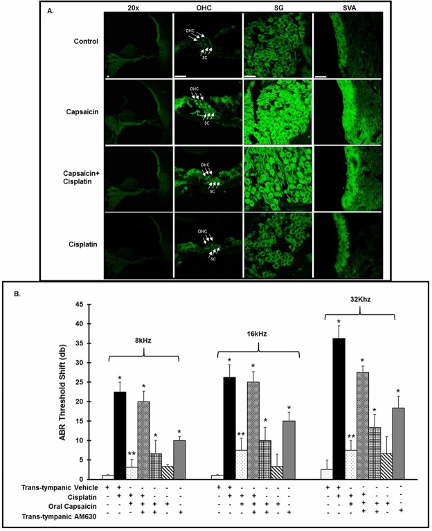 Cannabinoid receptors are expressed in the rat cochlea and CB2 receptor is integral to capsaicin mediated rescue of cisplatin-induced hearing loss. We treated male Wistar rats with oral PBS (1 ml) or oral capsaicin (10 mg/kg) and collected the cochleae 72 h later. (A) We immunolabeled mid-modiolar sections of rat cochleae for CB2R and imaged using confocal microscopy at 20X and 100X. We observed CB2R expression in outer hair cells (OHCs), supporting cells (SC’s), spiral ganglion cells (SG) and in the stria vascularis (SVA). Scale bar is 25 µm. (B) We pretreated rats were pretreated with AM630 (0.1 µM, TT), CB2R antagonist for 1 hour, then capsaicin (20 mg/kg, 1 ml) by oral gavage 24 hours prior to cisplatin administration (11 mg/kg i.p.). After 72 hours, we determined ABR threshold shifts at 8, 16 and 32 kHz. Pretreatment with capsaicin (20 mg/Kg solution) by oral gavage significantly reduced the threshold shifts caused by cisplatin. CB2 receptor antagonist AM630 (TT) abrogated the capsaicin protection against cisplatin. AM630 (TT) alone also caused ABR threshold shifts. Asterisks (*) and (**) indicate statistically significant increases from PBS and from cisplatin-treated animals, respectively (p < 0.05, n = 4).