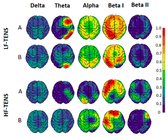 Dynamics of power spectrum density of delta, theta, alpha, beta I, and beta II rhythms before (A) and after weekly TENS (B) in all study groups. Notes: LF-TENS: low-frequency, high-amplitude transcutaneous electrical nerve stimulation; HF-TENS: high-frequency, low-amplitude transcutaneous electrical nerve stimulation.