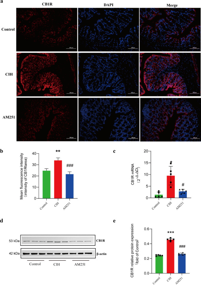 CIH promotes overexpression of CB1 receptor in colon tissue. a-b The expression of CB1 receptor in colon tissues was detected by immunofluorescence. c RT-PCR was used to detect the mRNA expression level of CB1 receptor in colon tissues. d-e The expression level of CB1 receptor protein in colon tissues was detected by western blot. *P < 0.05, **P < 0.01,***P < 0.001, compared with the Control group; #P < 0.05, ##P < 0.01,###P < 0.001, compared with the CIH group