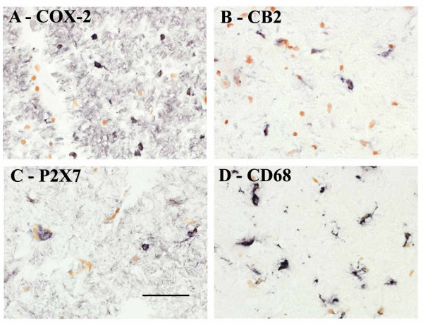 Microglial cells/macrophages in control spinal cord immunostained with antibodies to A) COX-2, B) CB2, C) P2X7, and D) CD68. Scale bar = 50 μm.