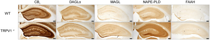 Immunoperoxidase method for light microscopy. Expression patterns of CB1R and endocannabinoid enzymes in WT and TRPV1−/− mice hippocampi. MAGL, NAPE-PLD, and FAAH immunoreactivity increases and DAGLα decreases in TRPV1−/−. CB1R immunoreactivity increases overall TRPV1−/− hippocampus. Scale bars: 500 μm.