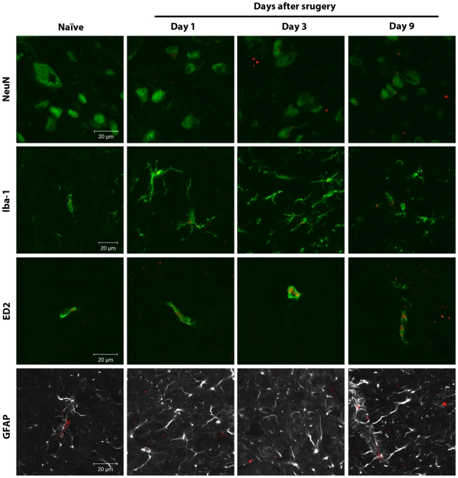 Spinal CB2 receptors are mainly expressed in microglial cells.Confocal analysis was used to determine CB2 receptor cellular localization in the superficial laminae of the L5 dorsal horn in naïve rats or ipsilateral to surgery in rats at days 1, 3 and 9 after paw incision. Representative images are shown. CB2 receptor staining appears in red. NeuN (marker for neurons), Iba-1 (marker for microglia) and ED2/CD163 (ED2, marker for perivascular microglia) appear in green. GFAP (marker for astrocytes) appears in grey. In the images of CB2 receptors and GFAP, GFAP staining originally appeared in green. The color of GFAP staining was digitally changed to grey in order to allow a better visualization of this specific marker and any potential staining of CB2 receptors. The colocalization of CB2 receptors with the other cellular markers is visualized in yellow.