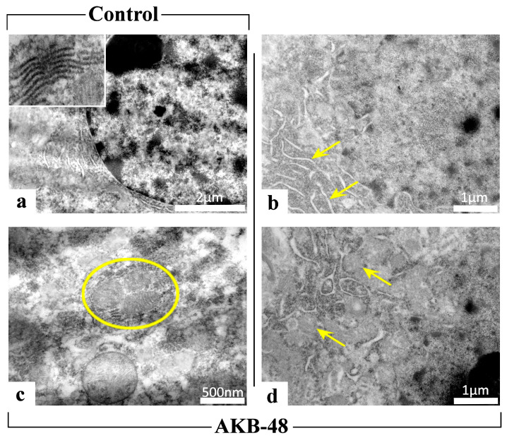 Transmission electron microscopy (TEM) images of control animals ((a), 20 K; inset 75 K) and AKB-48-treated mice (AKB-48) ((b), 25 K, arrows: ER; (c), 50 K, circle: mitophagosome; (d), 25 K, arrows: autophagic vesicles). n = 3/group.