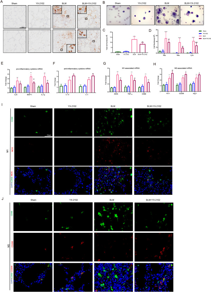 YX-2102 inhibits BLM-induced pulmonary inflammation in vivo. Rats were intratracheally treated with 5 mg/kg BLM once at day 0, followed by YX-2102 or vehicle treatment via intraperitoneal injection at 25 mg/kg daily. The rats were sacrificed at day 7 and sampled. A Immunohistochemical staining of lung tissues using anti-MPO or CD68 antibody. B Representative images of cells in BALF after Wright-Giemsa staining. C The cell count of BALF using a hemocytometer and D the number of macrophage (Mφ), lymphocytes (Lym) and neutrophils (Neu). E, F The mRNA expression of IL-6, MCP-1, IL-1β (E) and IL-10, IL-4 (F). G, H The mRNA level of TNF-α, iNOS, CD86 (G) and Ym-1, Arg-1, CD206 (). I, J Double immunofluorescence staining of CD68 (red)/iNOS (green) (I) and CD68 (red)/CD206 (green) in rat lungs. Nuclei were stained with DAPI (blue). The merged signal (yellow) indicated M1 or M2 macrophages, respectively. Data were expressed as mean ± SEM, n = 5, **P < 0.01, ***P < 0.001 versus Sham groups. #P < 0.05, ##P < 0.01, ###P < 0.001, ####P < 0.0001 versus BLM group