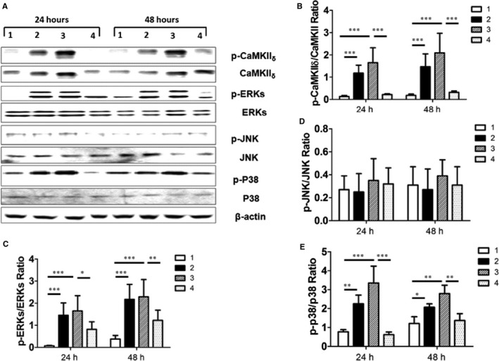 CAP induced cardiac hypertrophy in H9C2 cells through CaMKII δ and the mitogen‐activated protein kinase signaling pathway. A, Representative Western blotting products are shown from H9C2 cells treated with vehicle control (panel 1), 0.5 μmol/L CAP (panel 2), 2 μmol/L CAP (panel 3), and 2 μmol/L CPZ plus CAP (panel 4) for 24 or 48 hours; β‐actin was used as internal control. Quantitative assay of relative expression of p‐CAMKII δ to CaMKII δ (B) and relative expression ratios of p‐ERKs to ERKs (C), p‐JNK to JNK (D), and p‐P38 to P38 in (E) cells treated by vehicle control (panel 1), 0.5 μmol/L CAP (panel 2), 2 μmol/L CAP (panel 3) and 2 μmol/L CPZ plus CAP (panel 4) for 24 hour or 48 hours (6 independent experiments per group) are shown. *P<0.05, **P<0.01, ***P<0.001. CaMKII indicates calmodulin‐dependent protein kinase II; CAP, capsaicin; CPZ, capsazepine; ERK, extracellular signal–regulated kinase; JNK, c‐Jun N‐terminal kinase; p, phosphorylated.
