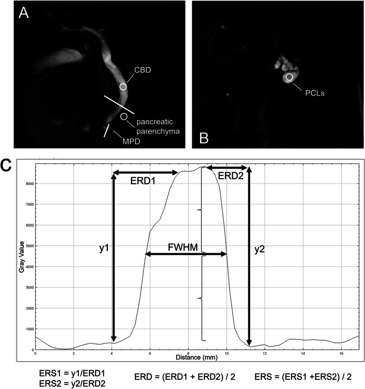 Measurement procedure of quantitative metrics. (a) Linear and circular region of interests (ROIs) (white thick line and white circles, respectively) were placed on the common bile duct (CBD). A linear ROI was placed on the distal main pancreatic duct (MPD). A circular ROI was placed on pancreatic parenchyma adjacent to the CBD. (b) A circular ROI was placed on pancreatic cystic lesions. (c) Signal intensity profiles of linear ROIs were obtained to calculate the edge rise distance (ERD), edge rise slope (ERS), and full width at half maximum (FWHM)
