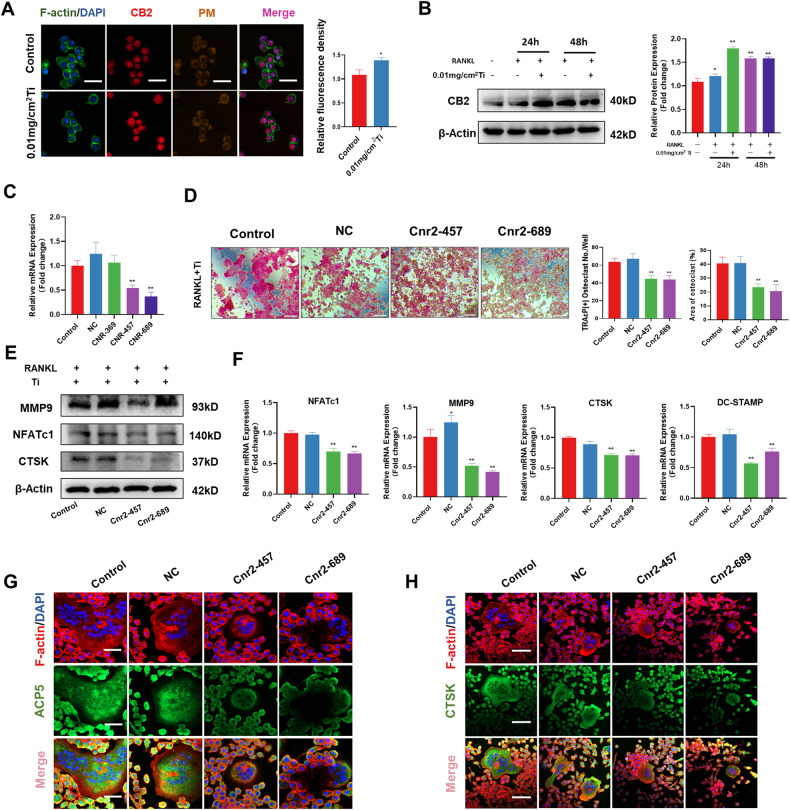 Inhibition of CB2 alleviated Ti particles-stimulated osteoclast activation.A Immunofluorescence assay was used to detect the expression and fluorescence quantification of CB2 under the intervention of Ti particles. Statistical significance was determined by Student’s t test. B Western blot assay and relative quantification of CB2 protein after intervention with Ti particles and RANKL. C RT-PCR was used to detect the effect of siRNA intervention on CB2 expression in RAW264.7. D Representative TRAcP staining was used to detect the effects of Cnr2-457 and Cnr2-689 on osteoclast differentiation and quantitative analysis of the number and area of osteoclasts per well. Scale bars, 200 µm. E Western blot revealed the effects of Cnr2-457 and Cnr2-689 on the expression of MMP9, NFATc1, and CTSK during osteoclast differentiation stimulated by Ti particles. F RT-PCR revealed the effects of Cnr2-457 and Cnr2-689 on osteoclast-related genes during osteoclast differentiation stimulated by Ti particles. G, H Immunofluorescence staining revealed the effects of Cnr2-457 and Cnr2-689 on the expression of ACP5 and CTSK. The data were represented as mean ± SD of three independent experiments. Statistical significance was determined by a one-way ANOVA with Tukey’s multiple-comparison test. *P < 0.05, **P < 0.01.