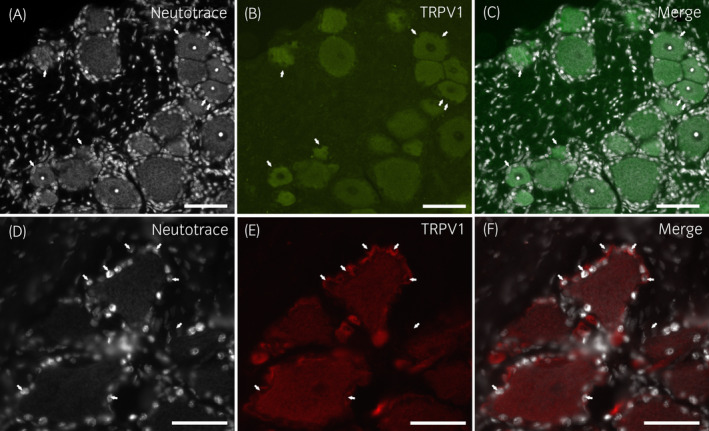 Photomicrographs of cryosections of a horse cervical (C8) dorsal root ganglion showing TRPV1‐immunoreactivity (IR). (A–C) Large proportions of sensory neurons showed TRPV1‐IR. Arrows indicate the nuclei of some perineuronal satellite glial cells expressing weak TRPV1‐IR. (D–F) Arrows indicate the nuclei of some bright TRPV1 immunoreactive satellite glial cells encircling sensory neurons expressing moderate TRPV1‐IR. Scale bar =50µm