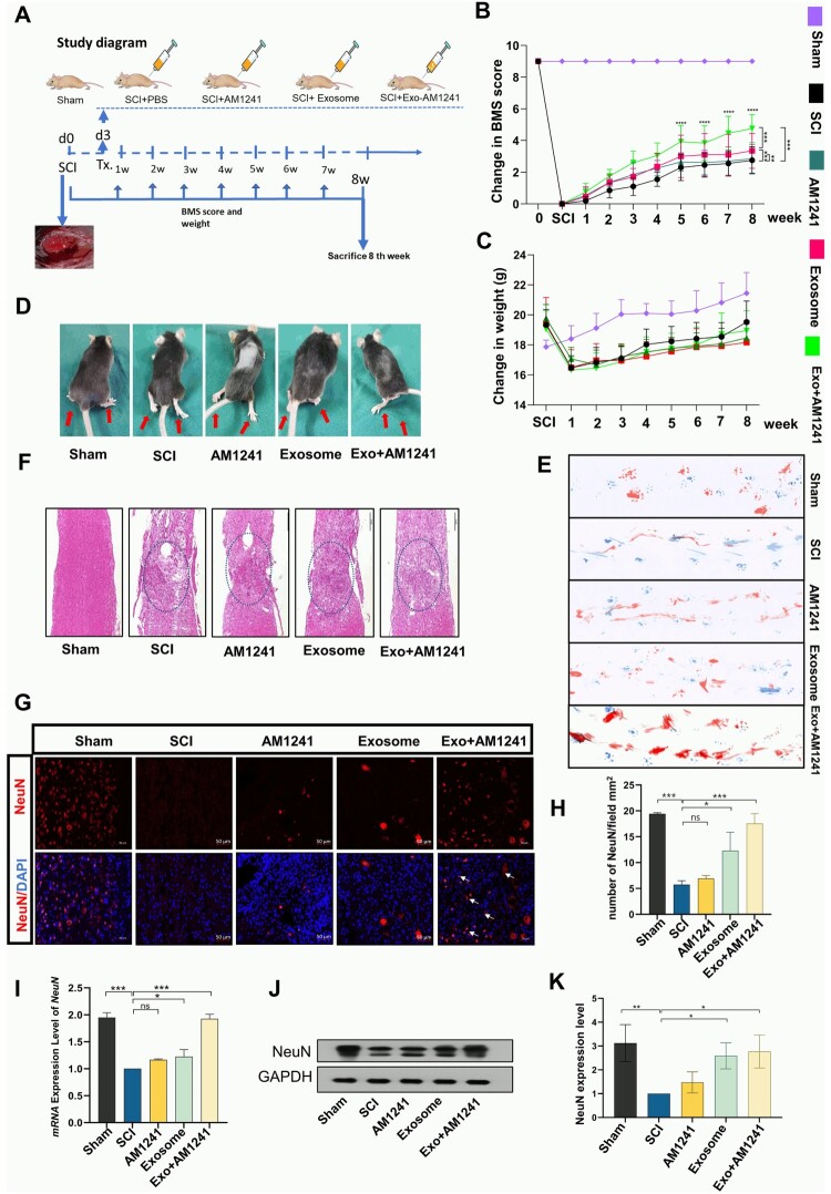 Exo + AM1241 Treatment Enhances Locomotor Improvement in SCI Mouse Model. (A) Experimental timeline showing Exo + AM1241 administration and locomotor function assessment post-SCI. (B) BMS scores over 8 weeks post-SCI showed significant locomotor improvement in mice treated with Exo + AM1241 compared to control groups (SCI, Exo alone, and AM1241 alone). (n = 12, mean ± SD, *p < 0.05, **p < 0.01, ***p < 0.001). (C) Weight of post-SCI mice showed no significant differences among the treatment groups (SCI, Exosome, AM1241 alone, and Exo + AM1241). (D) Improved coordination and movement in the Exo + AM1241-treated mice during stepping tasks post-SCI compared to SCI group. (E) Footprint analysis shows improved gait coordination in mice post-SCI, with blue footprints for upper limbs and red for lower limbs in the Exo + AM1241-treated group. (F) H&E-stained spinal cord sections showed preserved tissue and reduced lesions in the Exo + AM1241 group. (G-H) Immunofluorescence of spinal cord sections shows white arrows indicating neural cells and histogram shows increased neural cells (NeuN = red color) in Exo + AM1241-treated group (n = 3, Scale bar = 50 µm). (I) RT-qPCR analysis result of NeuN expression level in Spinal cord sections of SCI / treated Exo + AM1241 mice. (J-K) Western blot analysis result of NeuN protein expression in SCI mice model. (n = 3, mean ± SD, *p < 0.05, **p < 0.01, ***p < 0.001)