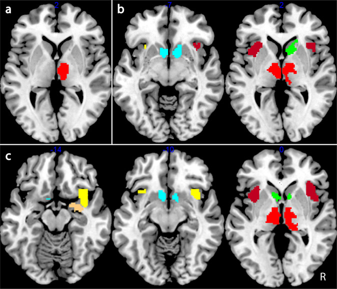 Validation analysis.Clusters of higher activation for reward + punishment versus neutral conditions for the valence (a) and magnitude (b) cue period as well as high versus low + neutral for the magnitude cue period (c). Clusters thresholded at p < 0.005 for visualisation purposes. Red = thalamus; green = caudate; cyan = nucleus accumbens; peach = amygdala; brown = dorsal anterior insula; yellow = ventral anterior insula.